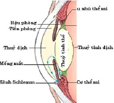 4. Nguyên Nhân Dẫn Đến Bệnh Lý Thủy Tinh Dịch